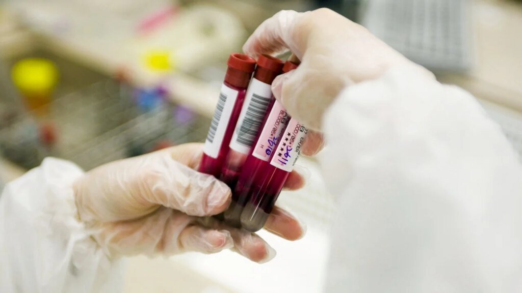 2 Hong Kong labs linked to suspected cross-border smuggling of blood samples