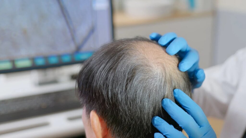 Hongkonger denied refund after HK$88,000 hair treatment causes scalp bleeding