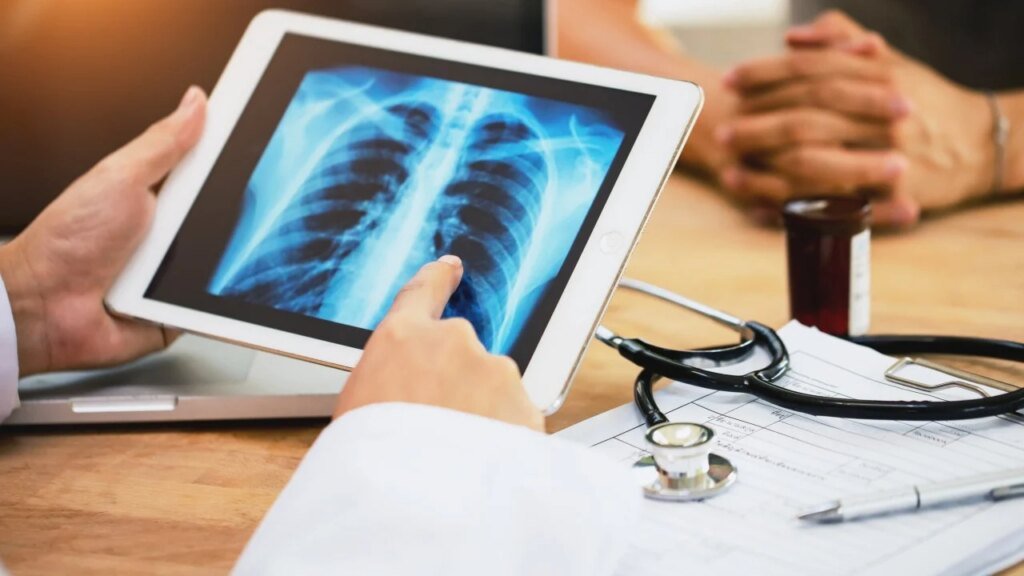 Patients given more hope as study finds best time for lung cancer treatment