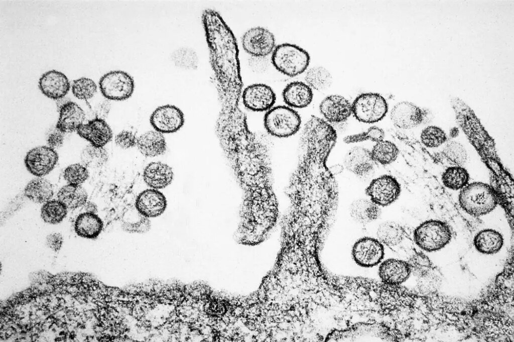 A microscope image of Hantavirus. Photo: Cynthia Goldsmith, USCDCP.